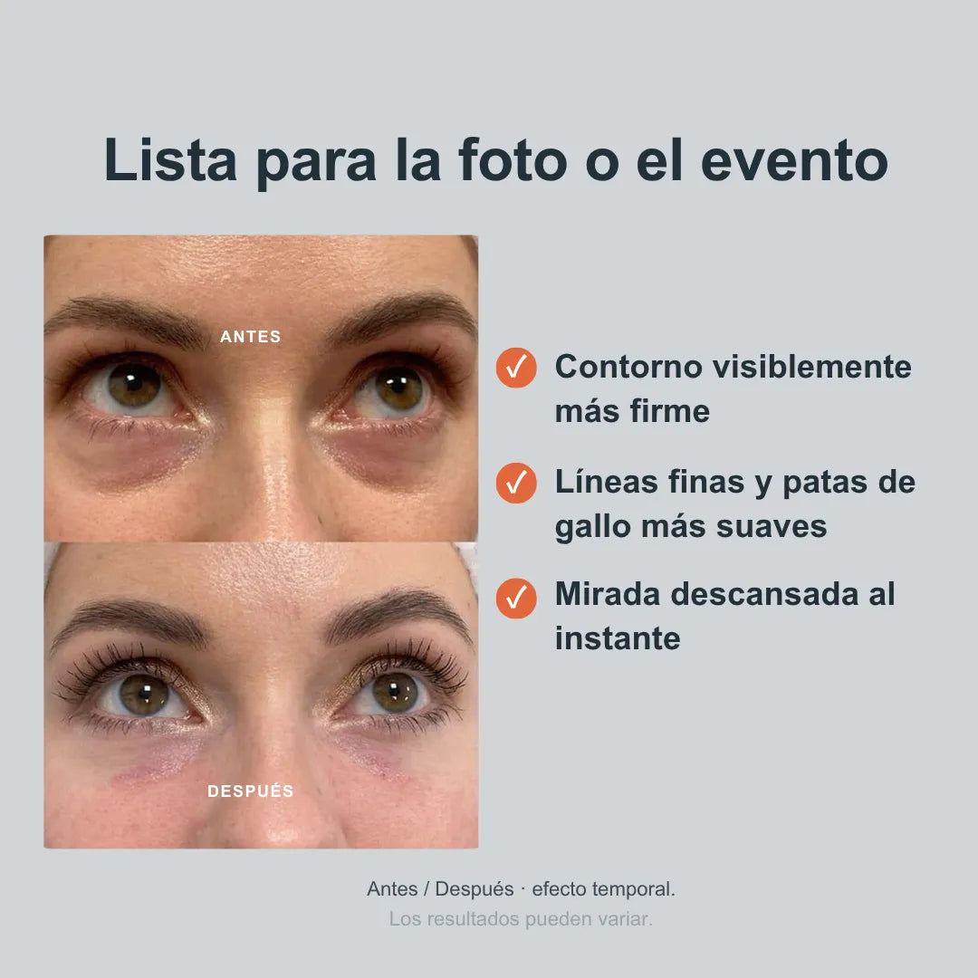 LIFTIX® Sérum tensor. Bolsas y arrugas visiblemente reducidas.
